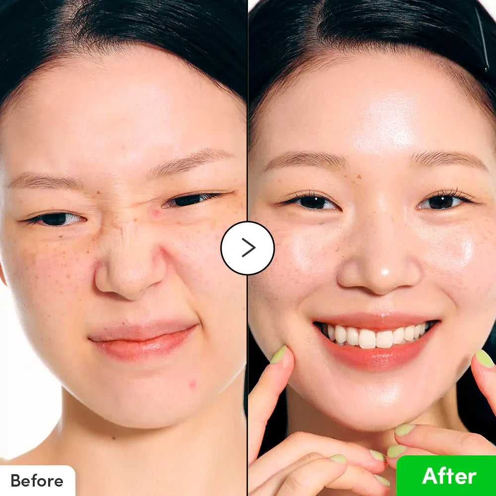 EQQUALBERRY Aloe PDRN Calming Serum for breakout-prone skin
