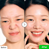 EQQUALBERRY Aloe PDRN Calming Serum for breakout-prone skin