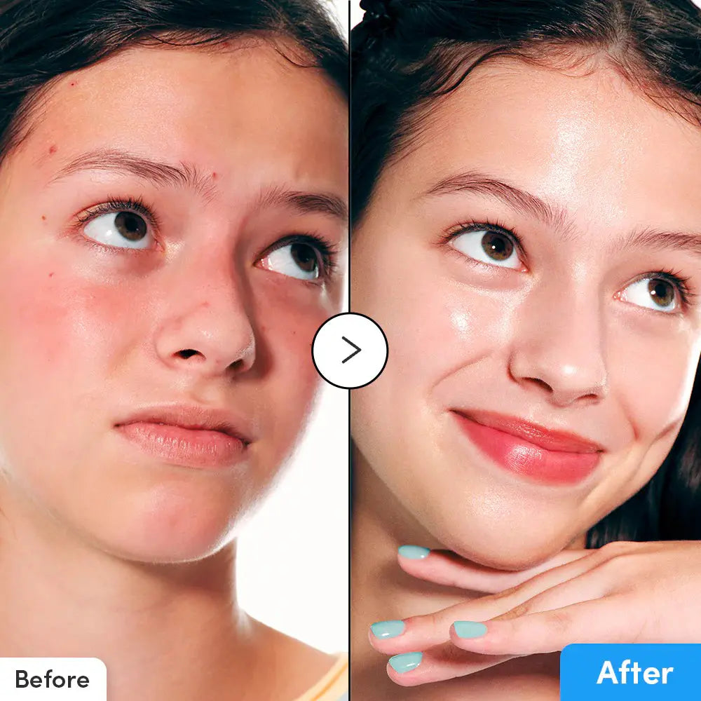 EQQUALBERRY Hyaltoin Flooding Serum for hydration