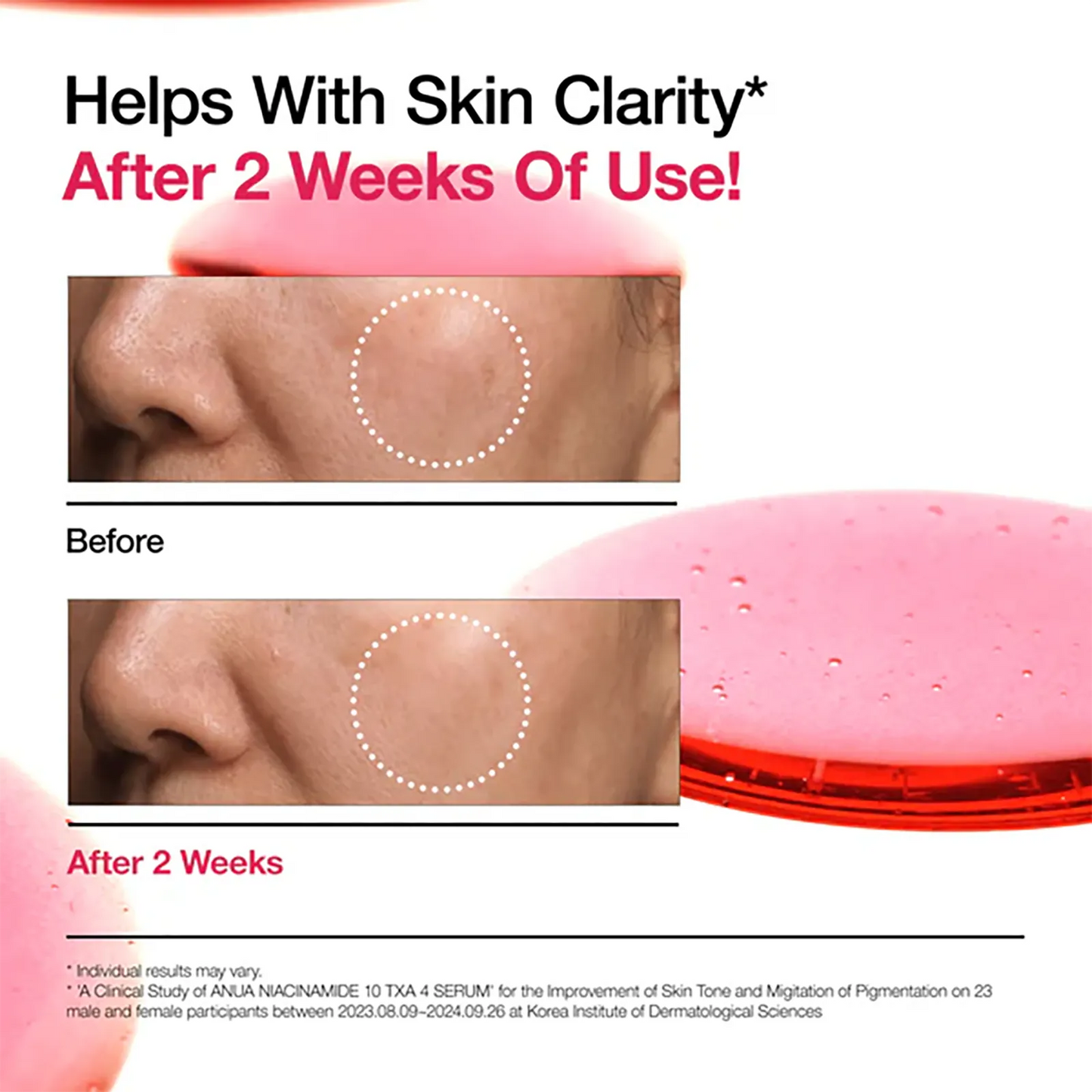 Anua Niacinamide 10 TXA 4 Serum product details