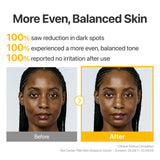 No.5 Glutathione TXA Advanced Dark Spot Ampoule Concentrate
